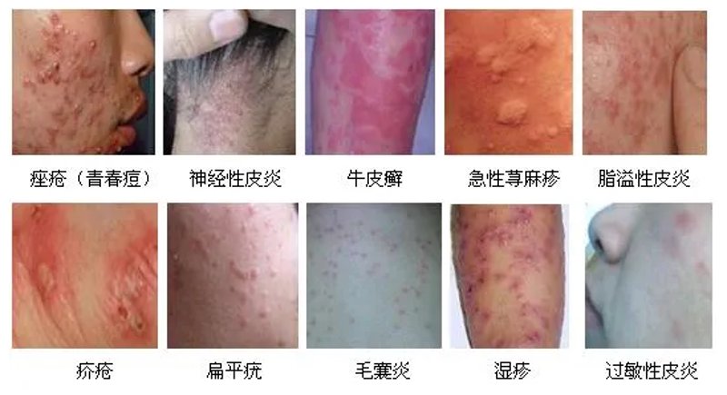 城市角落里的健康守护者:探访西岗区皮肤病诊所