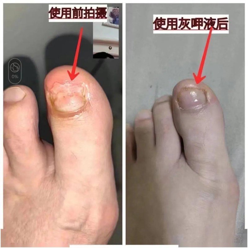 大连皮肤病医院:守护你的肌肤健康